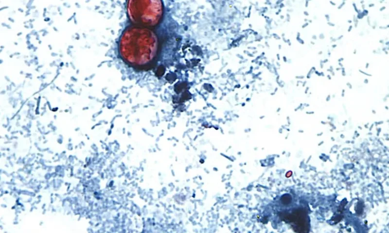 FDA liga fazenda no México a surto de Cyclospora nos EUA